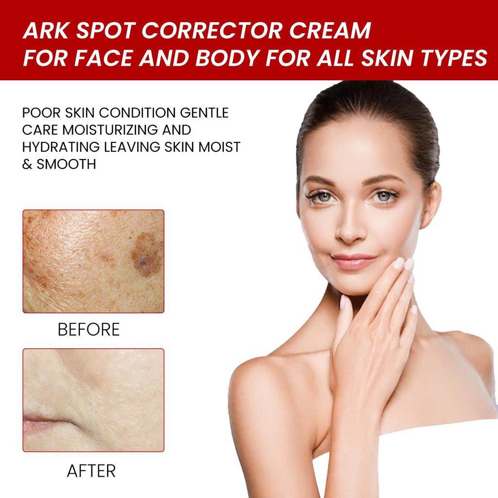 OUHOE Facial Care Cream, fades dark spots, hydrates and moisturizes, nourishes and repairs skin, brightens and whitens. Suitable for facial use, 20g.