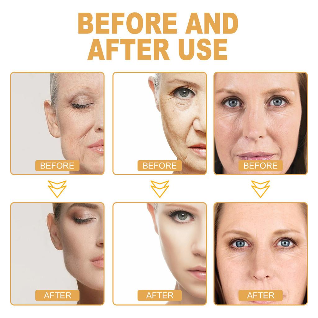 Hoygi Collagen Anti-wrinkle Serum For Deep Hydration And Skin Firming 30ml