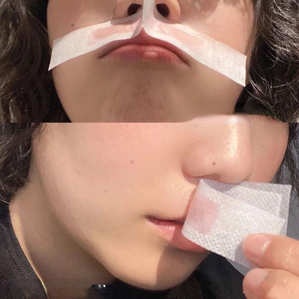 6/10/20pc Set Hair Removal Tool Wax Strips Waxing Wipe Sticker for Face Leg Lip Eyebrow Leg Arm Body Hair Removal Two Side Mini Size