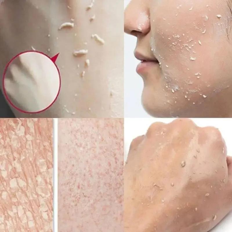 100ml Aufhellende Natürliche Papaya Gurke Kokosnuss Exfoliating Cream Peeling Gel Gesichtscreme Gesicht Körper Hautpflege Körper Feuchtigkeitsspendend Hand