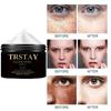 Whitening and Acne Removing Moisturizing Cream, Brightens Skin, Improves Skin Color, Moisturizing Cream