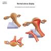Fortschrittliches pathologisches Gebärmuttermodell einer Frau für gynäkologische Studien, anatomische Simulation der Fortpflanzungs-/Eierstockstruktur.