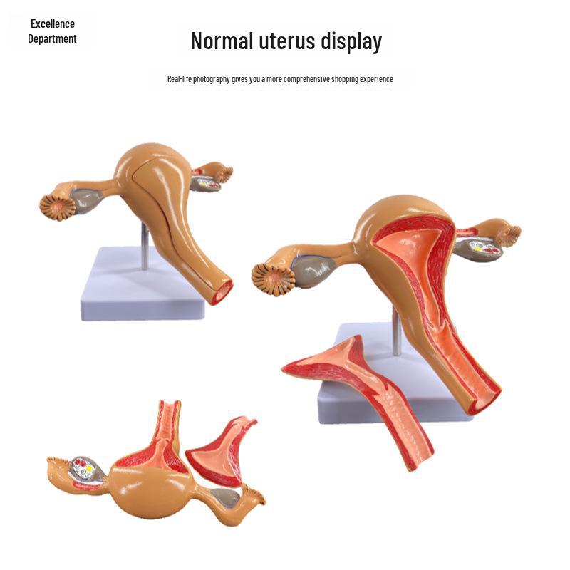 Fortschrittliches pathologisches Gebärmuttermodell einer Frau für gynäkologische Studien, anatomische Simulation der Fortpflanzungs-/Eierstockstruktur.