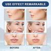 Collagen Wrinkle Removal Liquid Solution Anti-Aging Serum for All Skin Types
