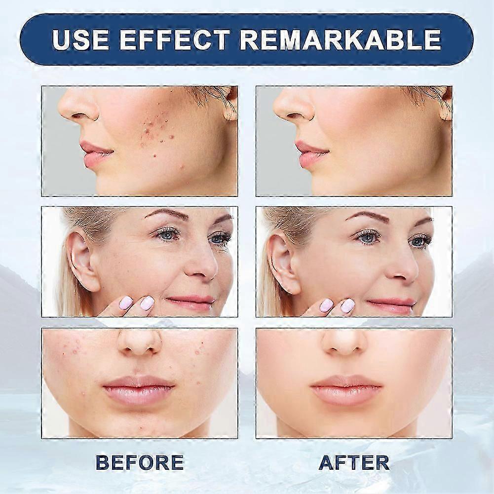 Collagen Wrinkle Removal Liquid Solution Anti-Aging Serum for All Skin Types
