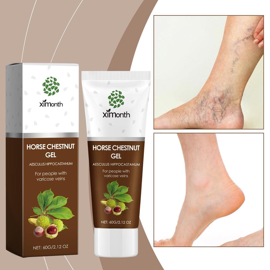 Varicose Veins Ointment Eliminate Spider Legs Vein Relieve Vasculitis Phlebitis Massage Moisturizing Legs Pain Treatment Cream