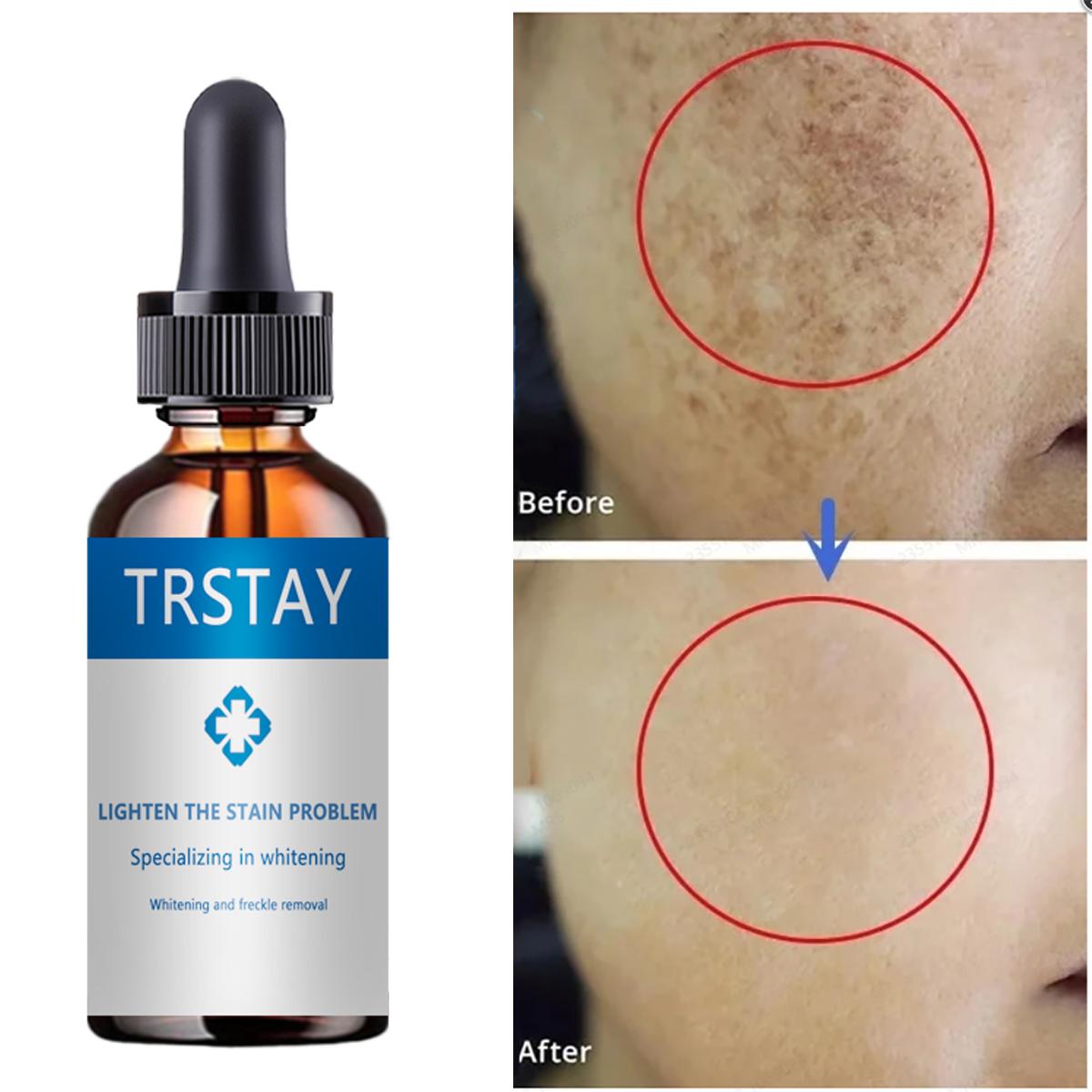 

Коллагеновый крем для лица с ретинолом и гиалуроновой кислотой, дневной и ночной антивозрастной увлажняющий крем для лица