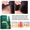 3pcs Ginseng Ginger Hair Regrowth Serum Spray Shougagro Japanese Hair Growth Spray