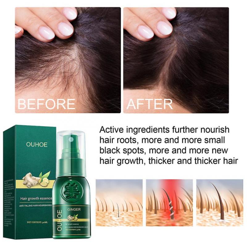 3pcs Ginseng Ginger Hair Regrowth Serum Spray Shougagro Japanese Hair Growth Spray