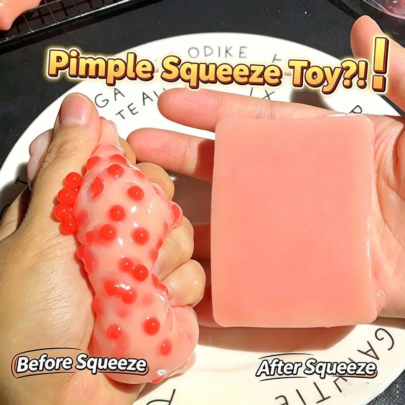 Pickel ausdrücken Squishy Spielzeug Simulation Akne quetschen Fidget Spielzeug Weiches Gel Entspannung Stressabbau Sensorisches Spielzeug Lustiges Streichgeschenk