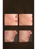 LED Red Light Therapy Face & Neck Mask Set - Photorejuvenation & Whitening Device