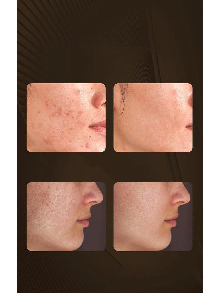 LED Red Light Therapy Face & Neck Mask Set - Photorejuvenation & Whitening Device
