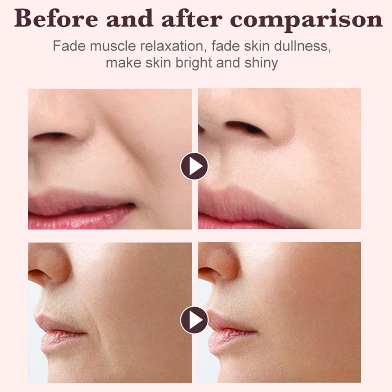 Cross-Border Nasolabial Fold Lifting Gel Patch: Firming, Skin-Friendly Anti-Wrinkle Facial Tape for Mouth Corners.