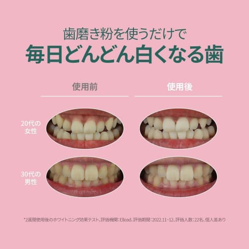 Eucimol White Pink Toothpaste, Peach Floral Mint Scent, 106g X 2-Pack