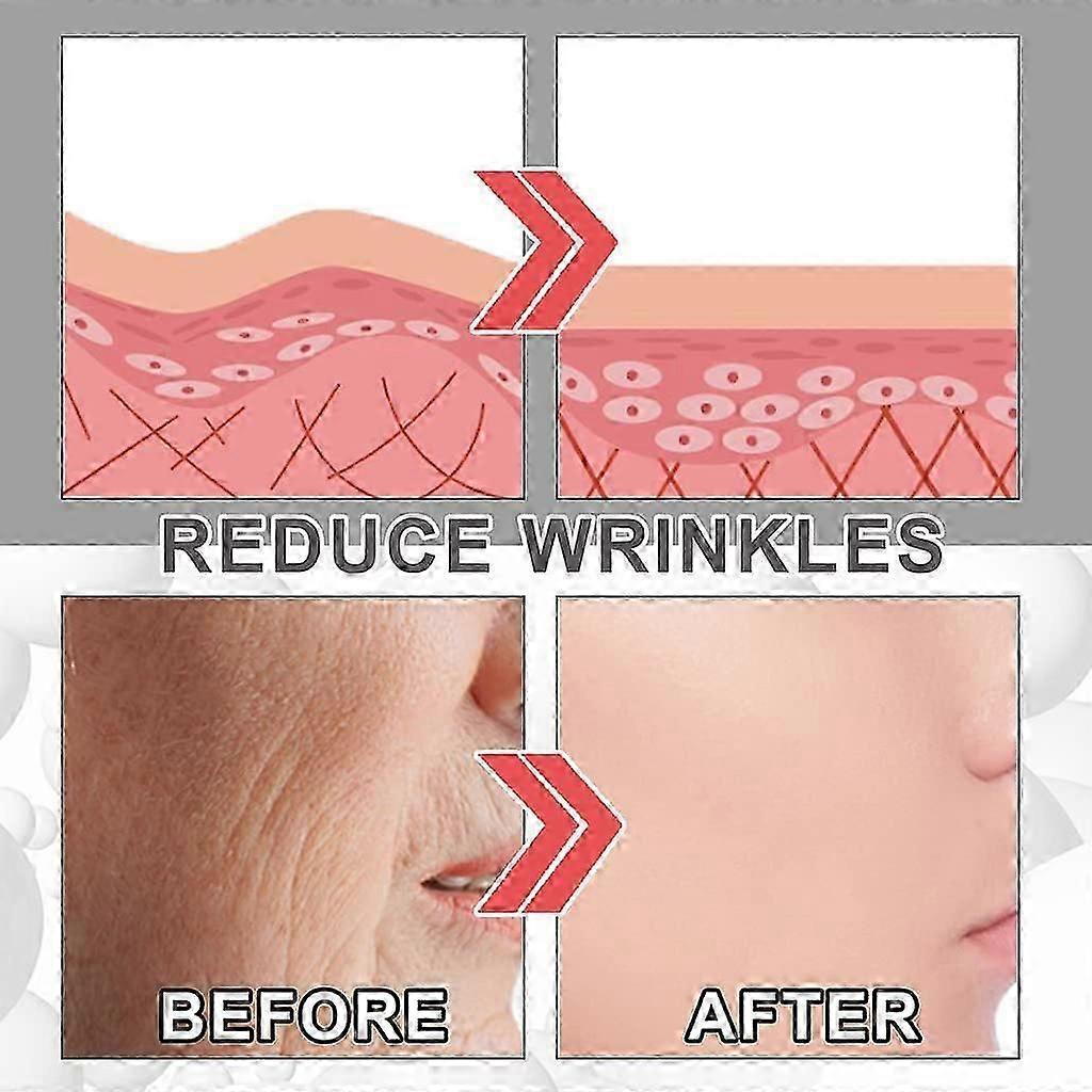 3 Pcs Collagen Boost Anti-Ageing Serum, 30ml Anti-Ageing Serum, Anti-Wrinkle Serum, Collagen Booster for Face