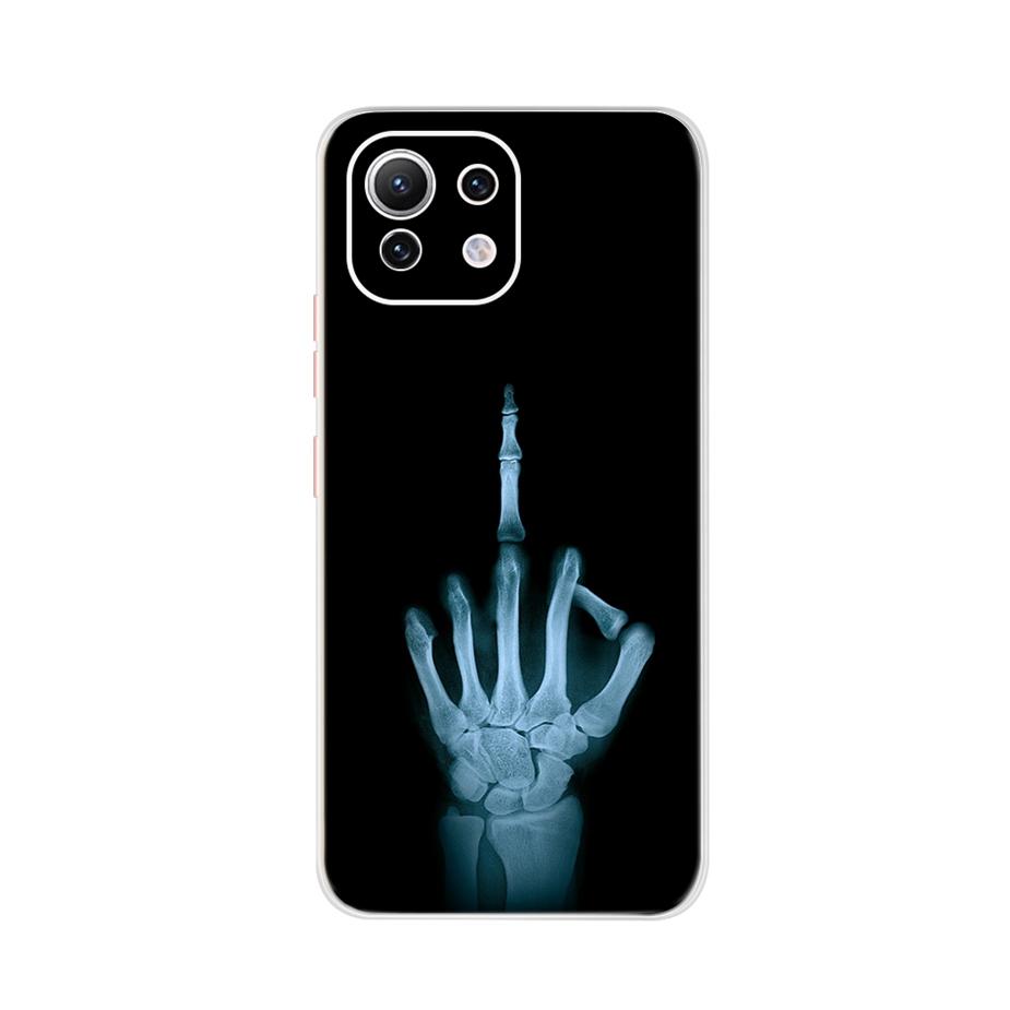 For Xiaomi Mi 11 Lite Case Cute Cartoon Cover For Xiaomi Mi 11 Lite 5G Phone Cases Mi11 Lite 11Lite Soft TPU Fundas Capa 6.55''