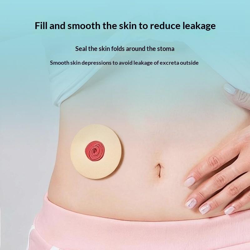 10Pcs Anti-Leakage Leak-Proof Ring For Colostomy Bag Ostomy Paste Ring Baseplates Stoma Care Products To Protect Skin 2/4Mm