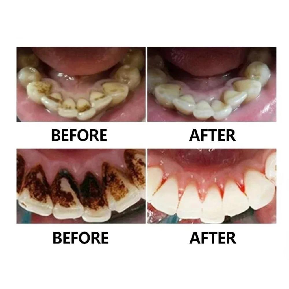 Lustro dentystyczne ze stali nierdzewnej, zestaw dentystyczny, torba, lusterko do ust, instrumenty dentystyczne, pielęgnacja jamy ustnej, wybielanie, usuwanie kamienia nazębnego, narzędzia