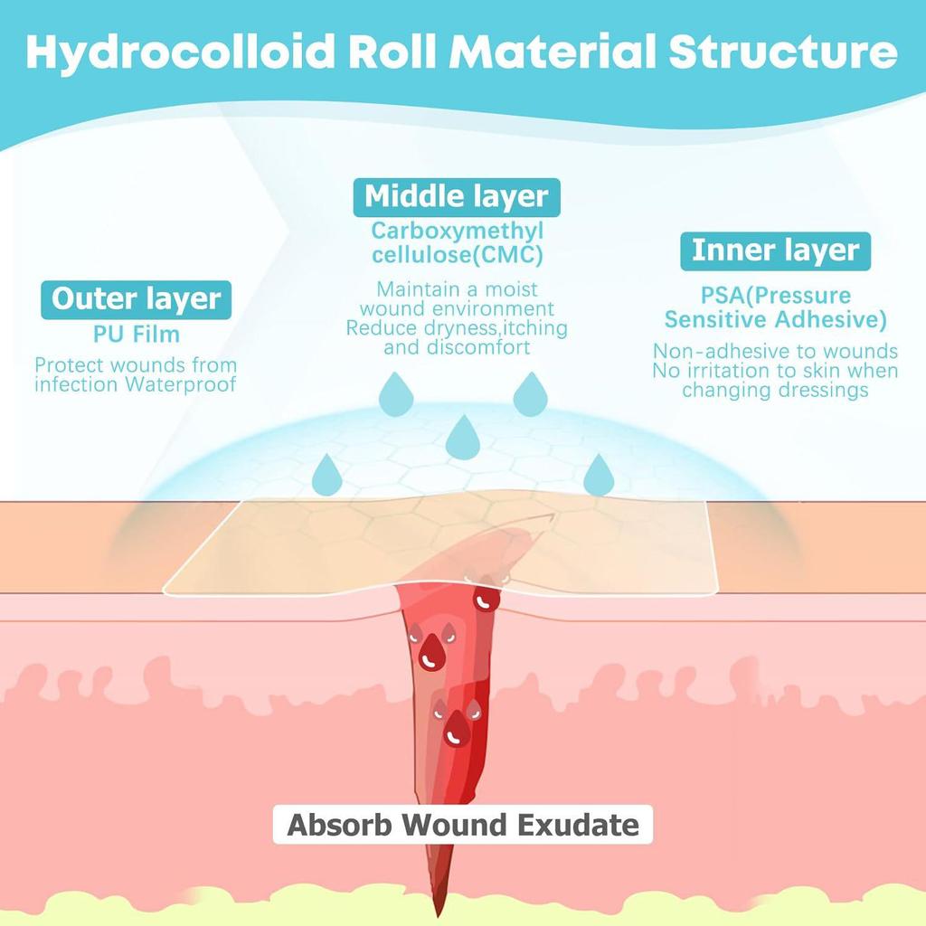 Hydrocolloid Dressing Roll: Moist Wound Healing & Acne Patch
