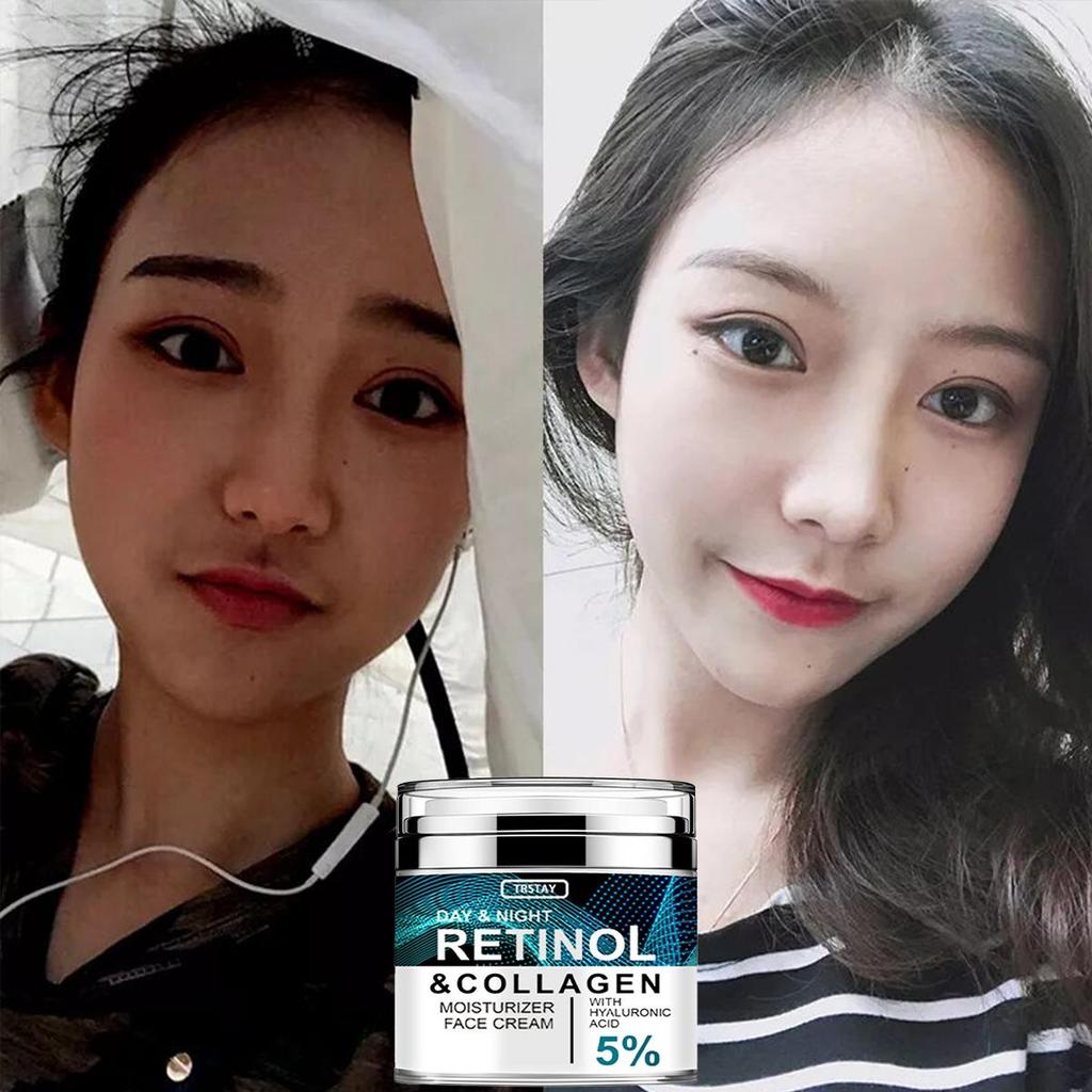 Regenerating, Firming, Whitening, Removing Dark Circles, Anti Wrinkle Collagen Face Cream