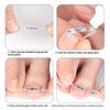 Ingrown Toenail Corrector Tools Pedicure Recover Embed Toe Nail Treatment Professional Ingrown Toenail Straightening Clip Brace
