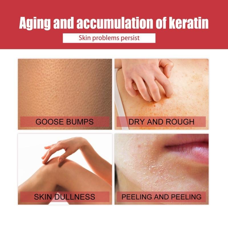 Eelhoe Body Care Essence Nourishing Firming Gel For Belly Arms And Thighs