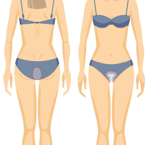 Swimming Private Patch for Women Waterproof Private Patches Dirt Protection Adhesive Sticker Skin-Friendly Panty Liner for Swimming Daily Activities