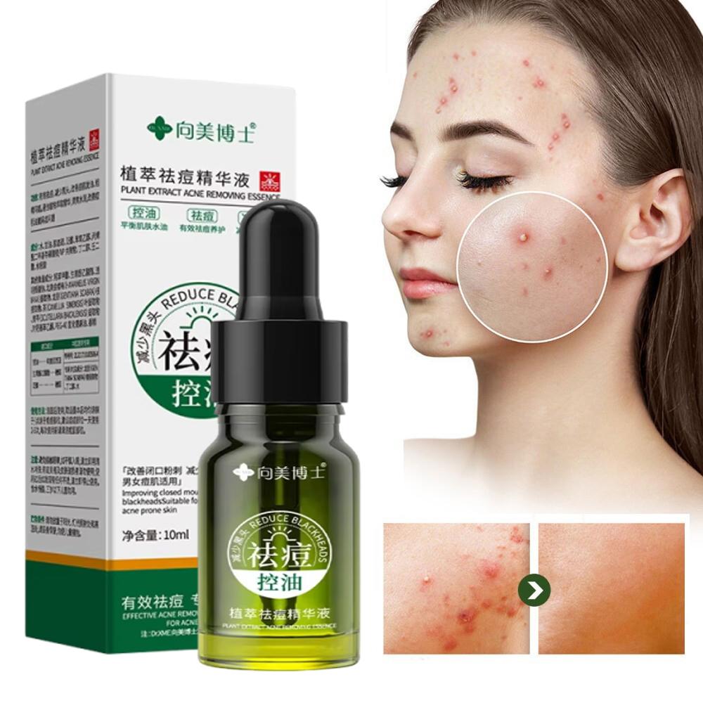 Plant Extract Acne Removal Cream Anti-Acne Repair Redness Pimple Spots Deep Cleaning Pore Oil Control Moisturizing Skin Care