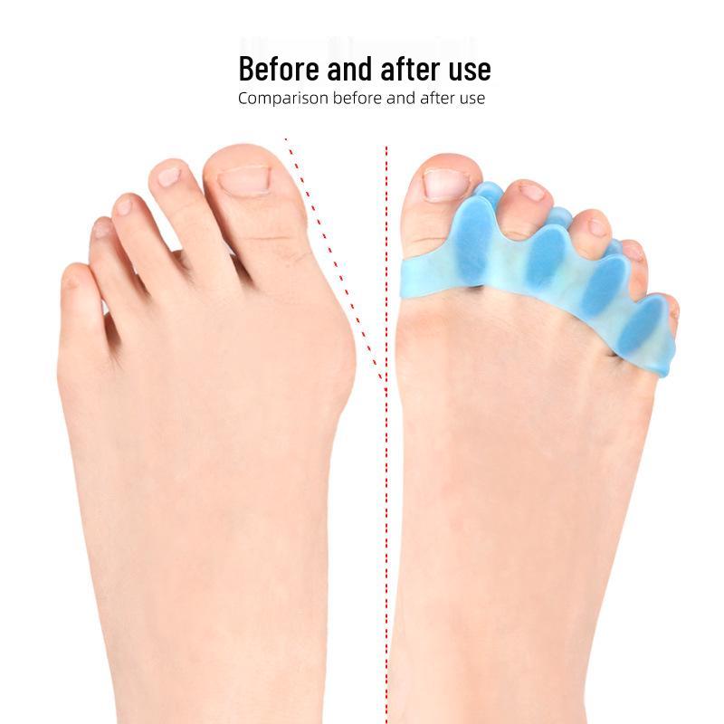Adult & Children's Hallux Valgus Five-Toe Separator Foot Corrector for Overlapping Toes