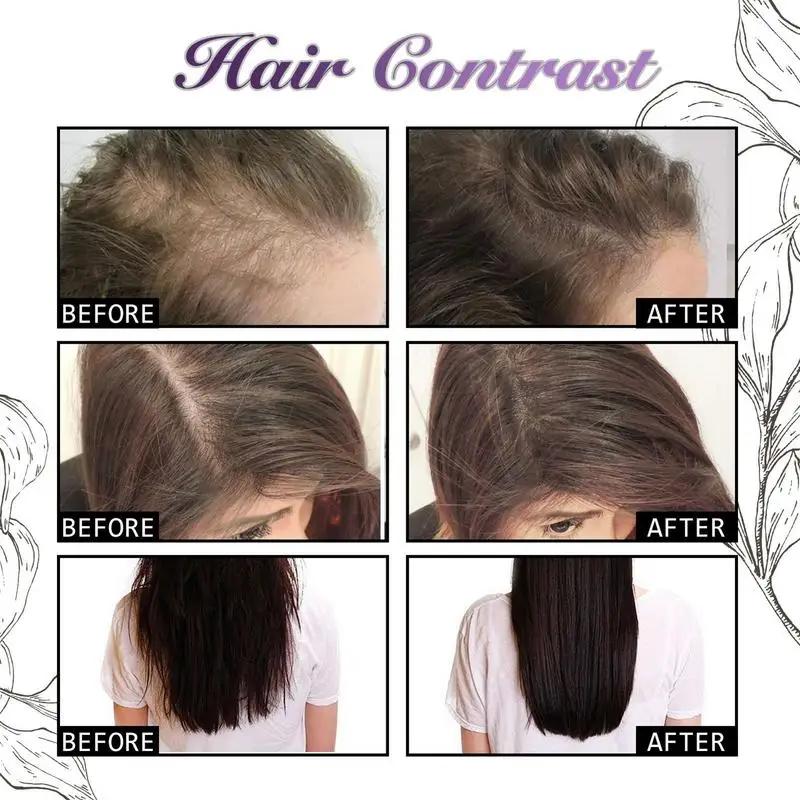 Hair Rapid Growth Essential Oil Onion Rosemary Hair Care Essential Oil Hair Regeneration Effective Hair Loss Product