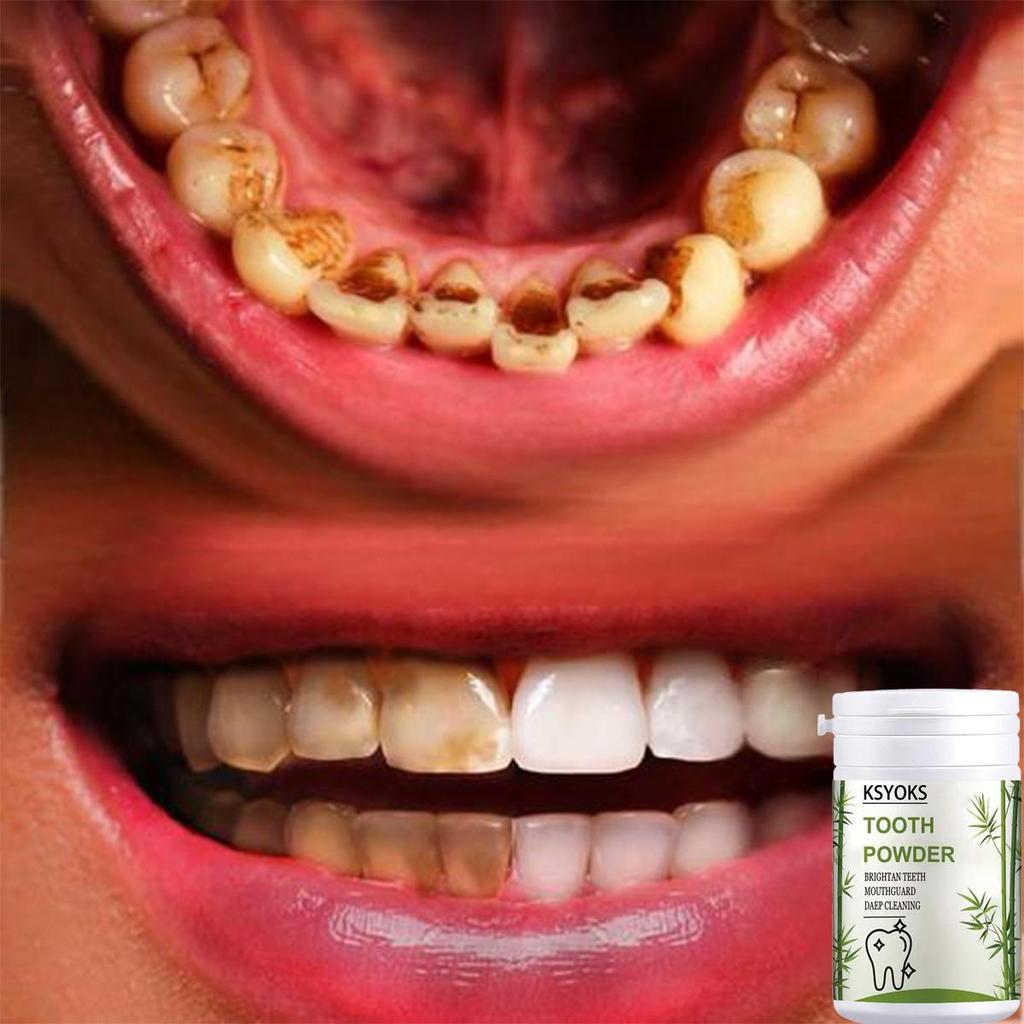 Whitening Teeth, Cleaning and Protecting Teeth Feels Very Comfortable To Use