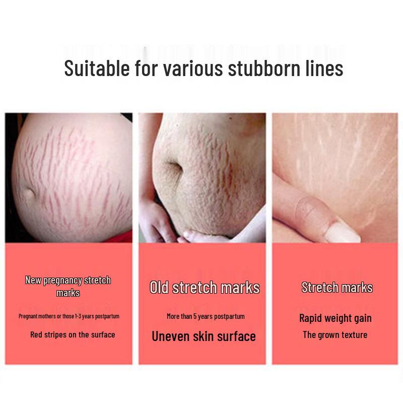 Postpartum Stretch Mark & Scar Repair Cream: Fade Pregnancy Scars & Fat Lines, Tighten & Soothe Skin