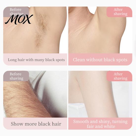 Wet Dry Electric Epilator Women Dual-Head Shaver, Rechargeable IPX7 Waterproof Bikini Trimmer, Razor Hair Removal for Face Body Underarms Legs Trimmer
