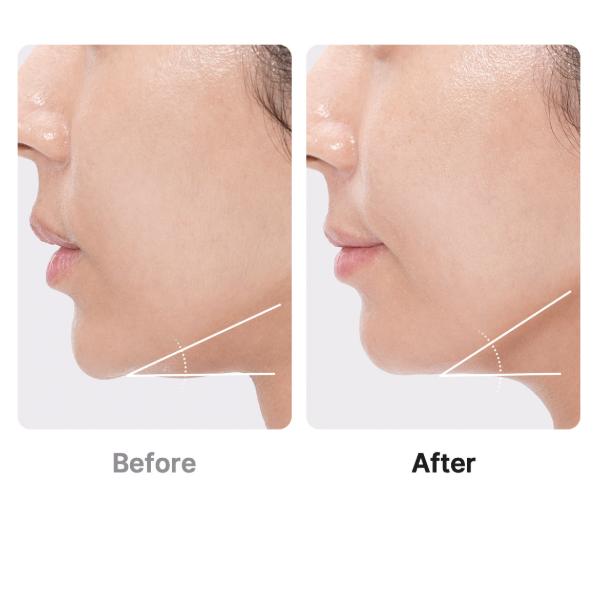 Medicube [AGE‑R] Booster Pro