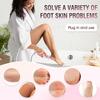 Electric Callus Remover: Adjustable File with 60 Abrasive Discs — Professional Pedicure Tool for Men and Women (Dead Skin Removal)