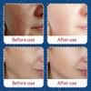 SADOER Christmas Hyaluronic Acid Hydrating Mask Emollient Hydrating Mask Patch