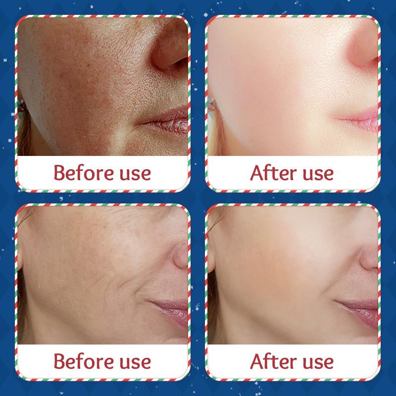 SADOER Christmas Hyaluronic Acid Hydrating Mask Emollient Hydrating Mask Patch