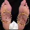 5G/15G/30G/50G/TRSTAY Foot Cream Cares for Foot Skin