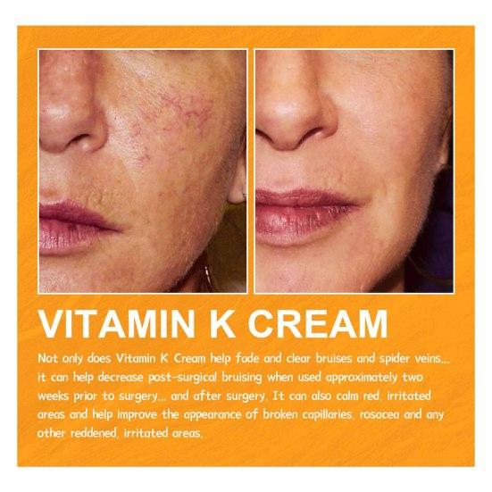 60G Varicose Vein Cream Natural Relief Promotes Healthy Circulation Vitamin K Cream for Leg Soreness Swelling