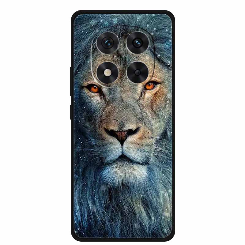 For Xiaomi Redmi Note 15 Pro 5G Case Global Soft Silicone Back Cover for Redmi Note 15 Pro+ Note15 Pro Plus TPU Funda Back Coque
