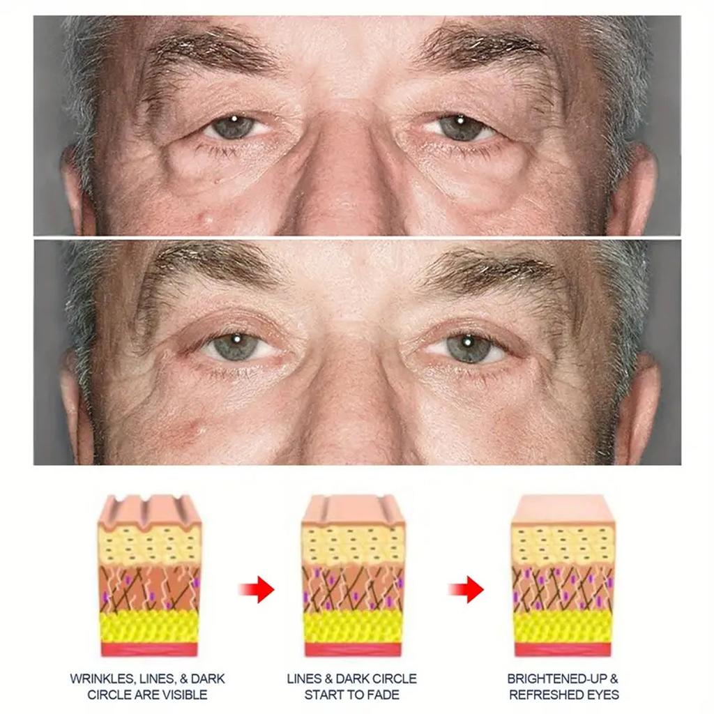 Pánský krém proti vráskám na oči 50g Zpevňuje, vypíná, hydratuje, redukuje tmavé kruhy, jemné linky, zlepšuje váčky pod očima