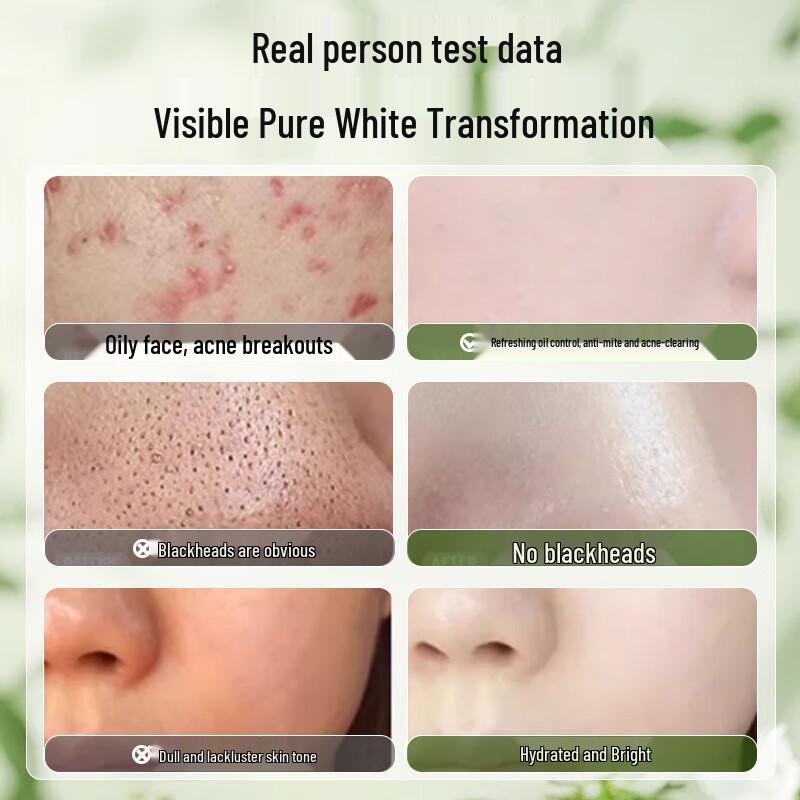 HIEUAILR German Whitening & Brightening Amino Acid Cleanser