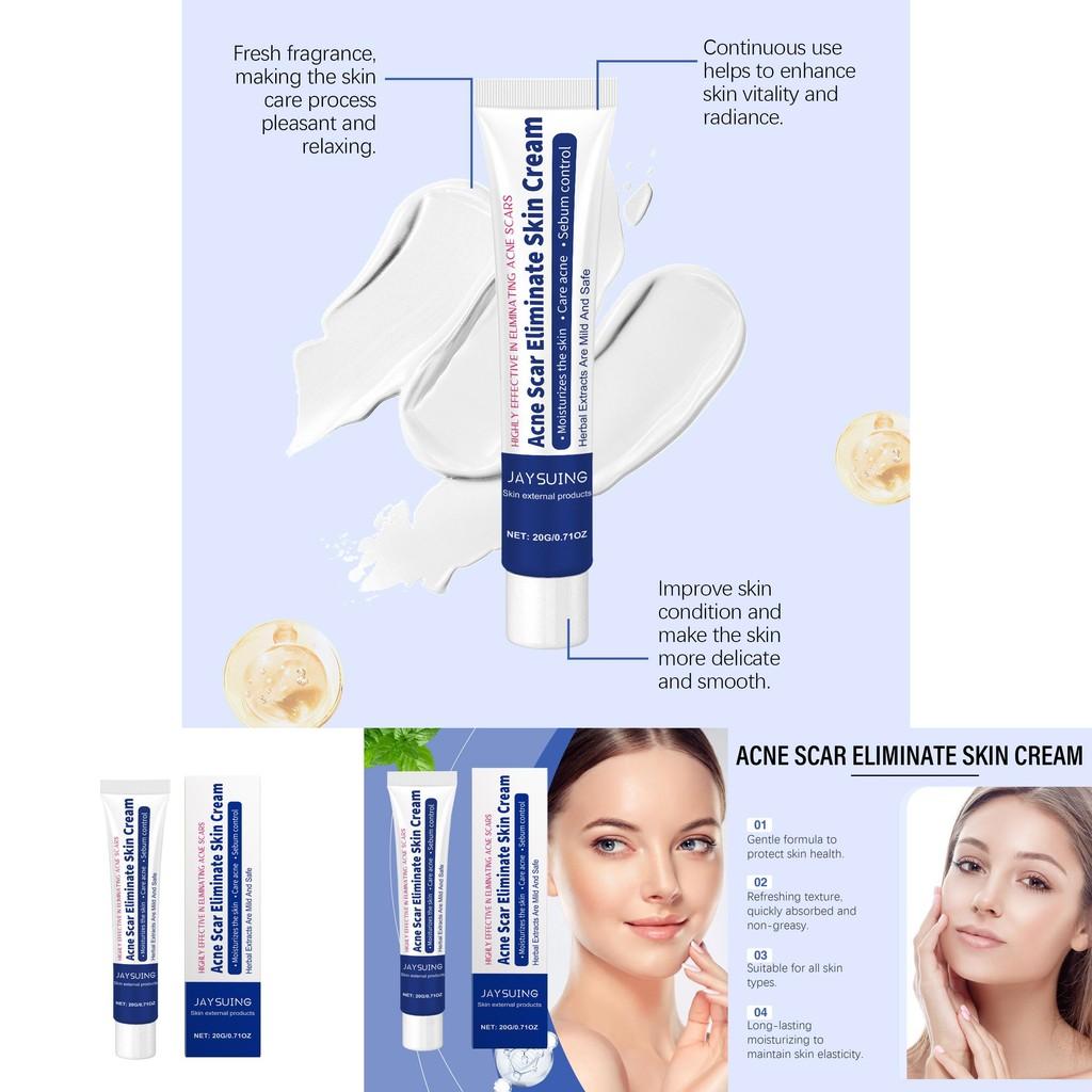 Jaysuing Herbal Acne Cream Refreshing Oil Control Gentle Cleansing Moisturizer For Skin