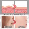 Collagen Boost Anti-aging Serum, Collagen Boost Anti Aging Serum Voletas Collagen Boost Anti-aging Serum Anti Wrinkle Serum
