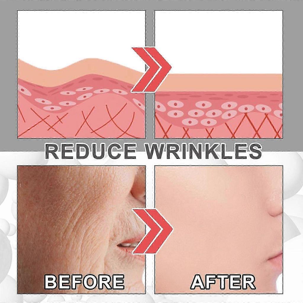 Collagen Boost Anti-aging Serum, Collagen Boost Anti Aging Serum Voletas Collagen Boost Anti-aging Serum Anti Wrinkle Serum