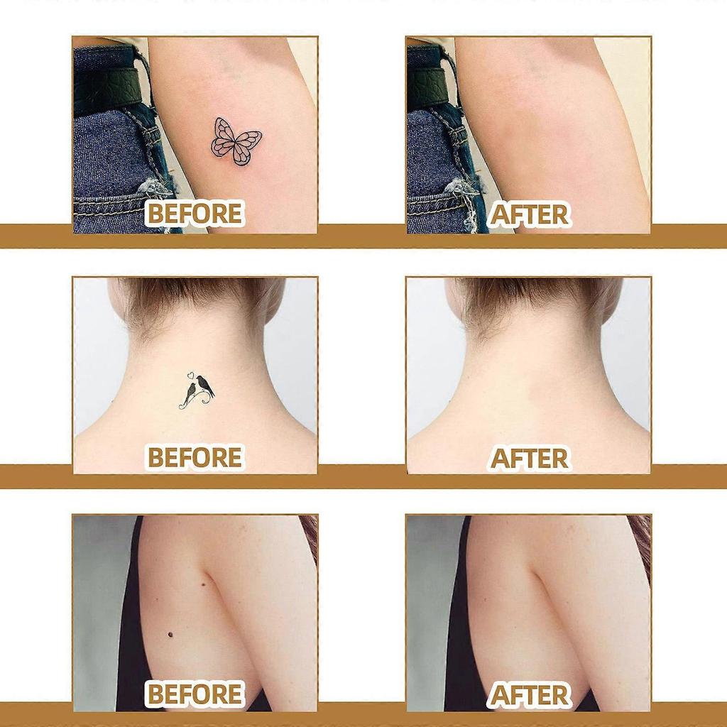 Skin Invisible Concealer Patch Skin Scar Tattoo Acne Mark Cover Patch Waterproof Skin Color Invisible Patch 60pcs