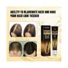 Biotin Hair Growth Serum, Biotin Hair Regrowth Serum for Scalp Loss Treatment, Topical Hair Growth Solution Roller for Thicker, Thicker Hair
