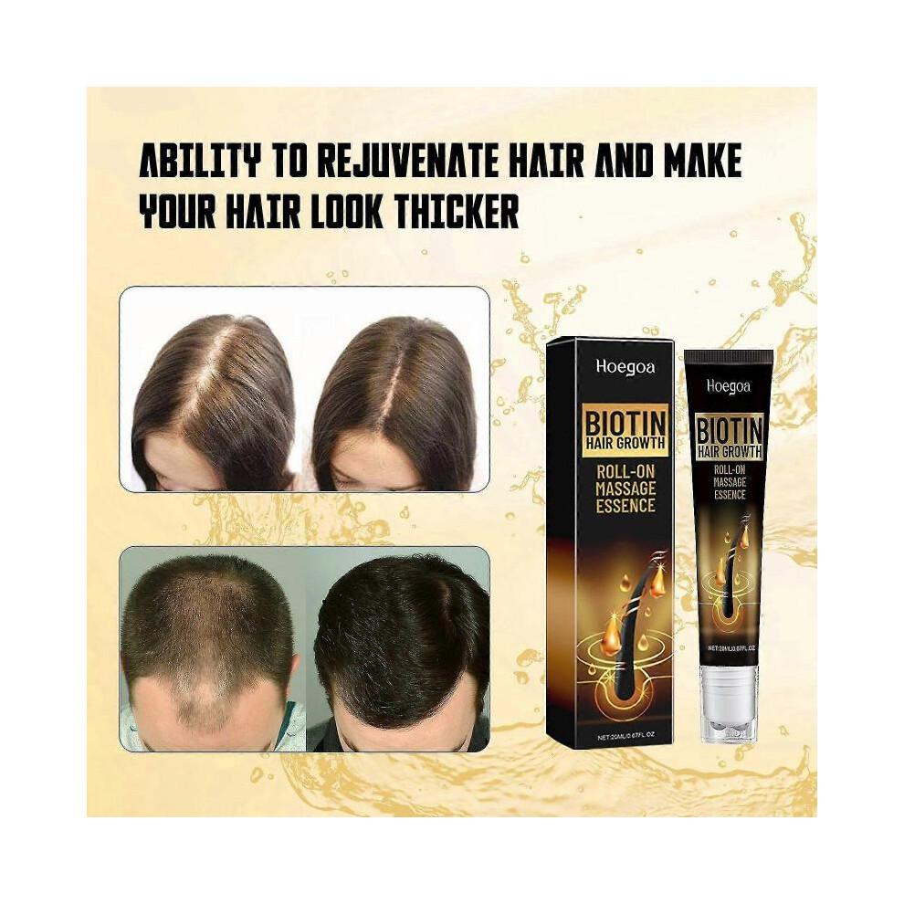 Biotin Hair Growth Serum, Biotin Hair Regrowth Serum for Scalp Loss Treatment, Topical Hair Growth Solution Roller for Thicker, Thicker Hair
