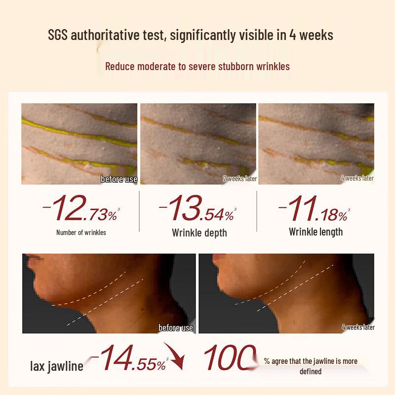 HBN Crema Retinolo Lifting & Rassodante per il Collo 2.0