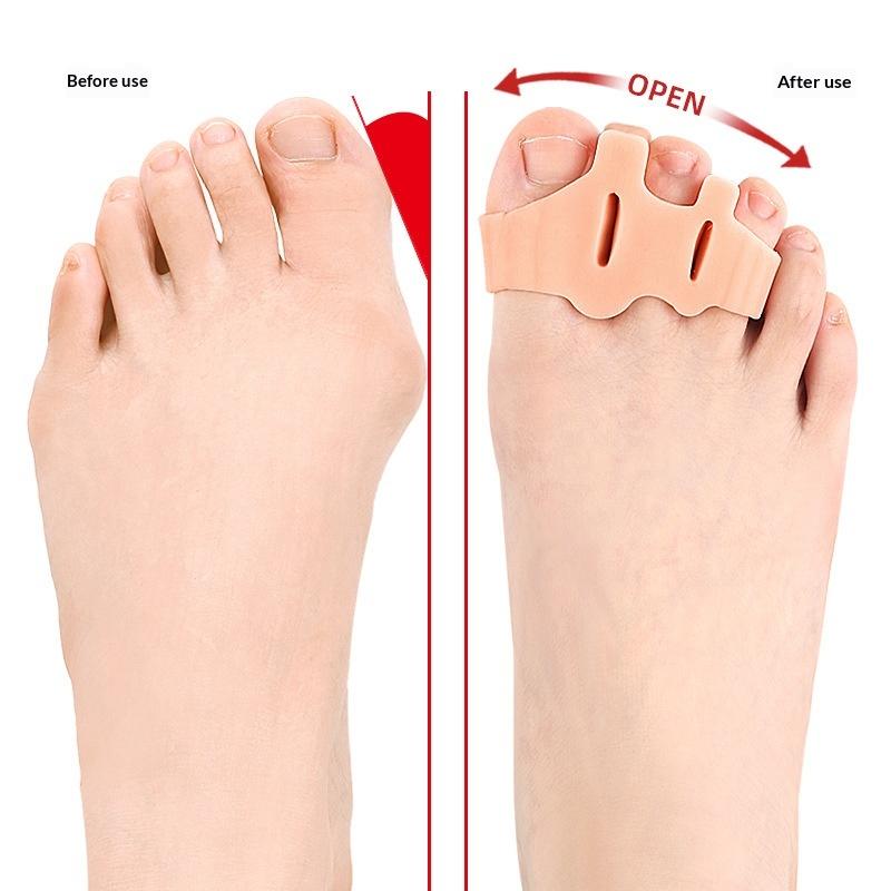 1 Pair Toe Finger Separator 3 Hole Hallux Valgus Orthopedic Spacers Overlapping Hammer Foot Corrector Straightener Pedicure